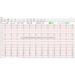 LOGICIEL POUR CARDIOMATE 3,6,12 & PC-ECG - Spengler 