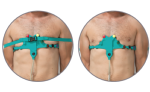 Ceinture ECG à sangles avec connecteur dédié sans vis 