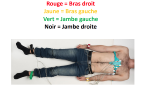 Ceinture ECG à sangle avec connecteur dédié à vis LevMed