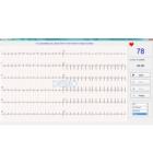 ÉLECTROCARDIOGRAPHE NUMÉRIQUE USB/BLUETOOTH EDAN SE-1010