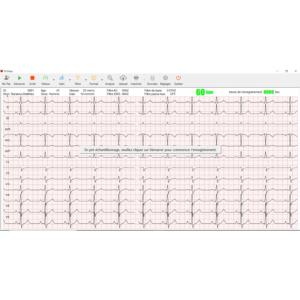 LOGICIEL POUR CARDIOMATE 3,6,12 & PC-ECG - Spengler 